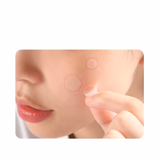 Hydrocolloid Acne Patch with Colorful Shapes From Chinese Manufacturer