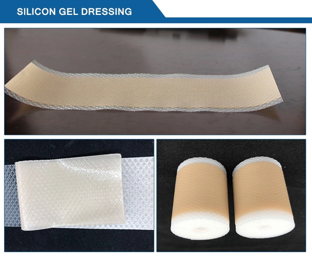 High Quality Disposable Medical Calcium Alginate Wound Dressing