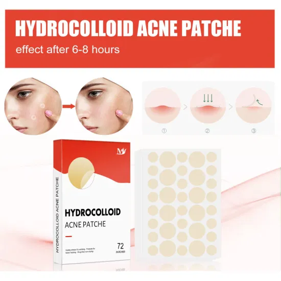 OEM Acne Skin Care 72 Patches Hidrocolóide Impermeável Acne Espinha Absorvente Capa e Mancha